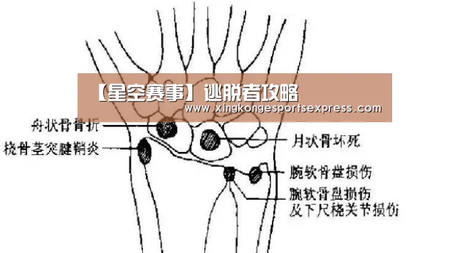 【星空赛事】逃脱者攻略(图1) 星空直播